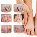 30/60/120 pç Adesivos para tratamento de fungos nas unhas dos pés.